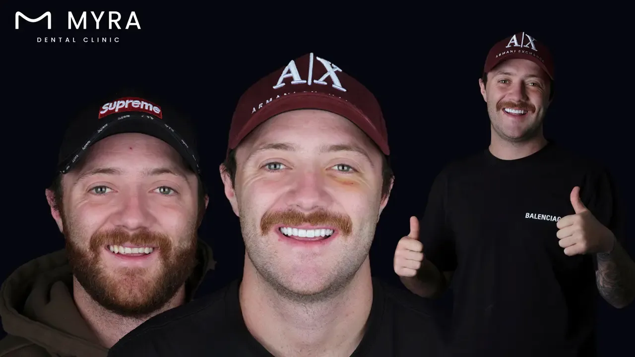 What is the patient satisfaction rate for veneers in turkey vs. the uk